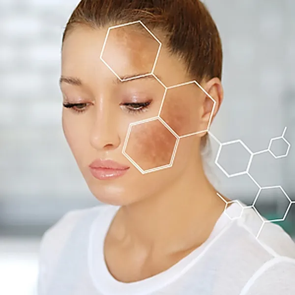 Manchas e Melasma — Dra. Raisa Resende
